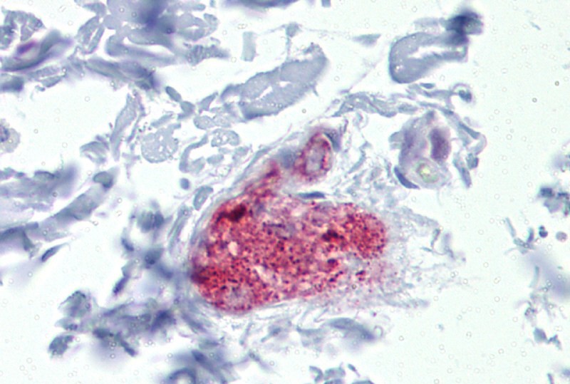 NOTCH4 antibody - middle region