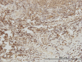 MGMT Antibody (monoclonal) (M01)