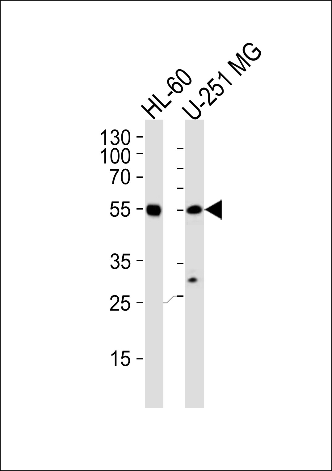 RELA Antibody
