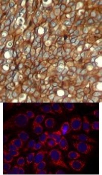 HER2 (phospho Tyr1248) Antibody