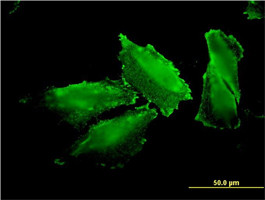 MARS Antibody (monoclonal) (M01)