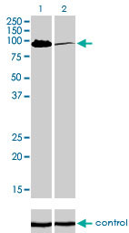 MCC Antibody (monoclonal) (M01)