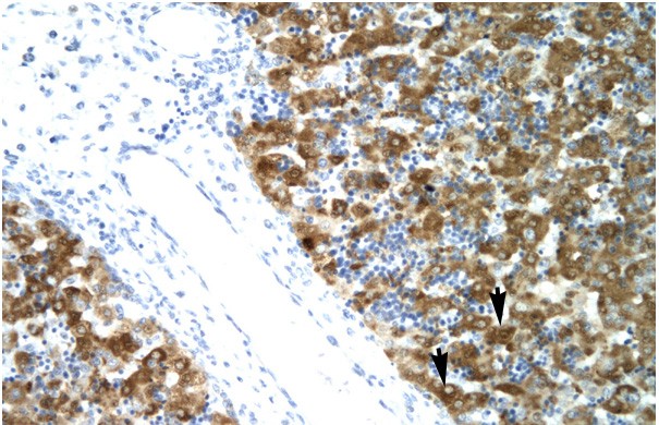 NFYA antibody - C-terminal region