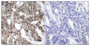 Akt antibody