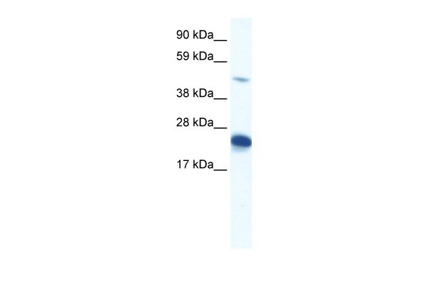 ZFP57 antibody - N-terminal region