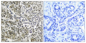 Androgen Receptor antibody