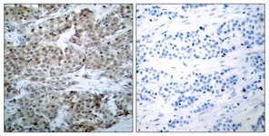 BAD (Phospho-Ser112) antibody
