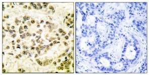 STAT5B (Phospho-Ser731) antibody