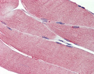 IGF1R Antibody, Monoclonal