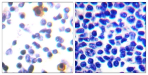 ZAP-70 (Phospho-Tyr315) antibody