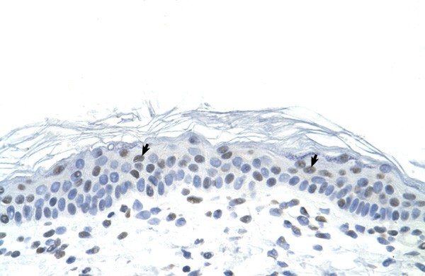 FOSL1 antibody - middle region