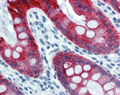 Cytoke Antibody