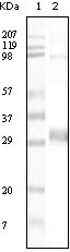 NPT Antibody