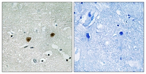 AKT1/2/3 (Phospho-Tyr315/316/312) antibody