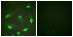 p53 (Acetyl-Lys379) antibody