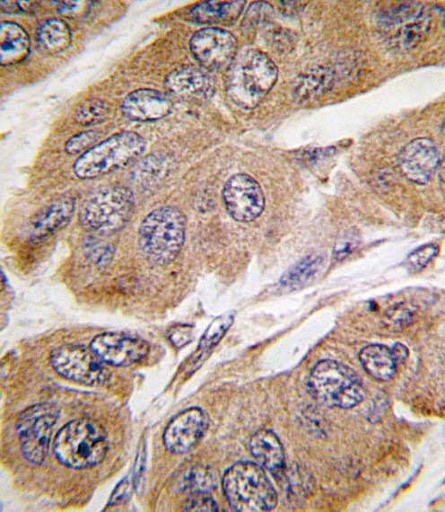 S6K Antibody
