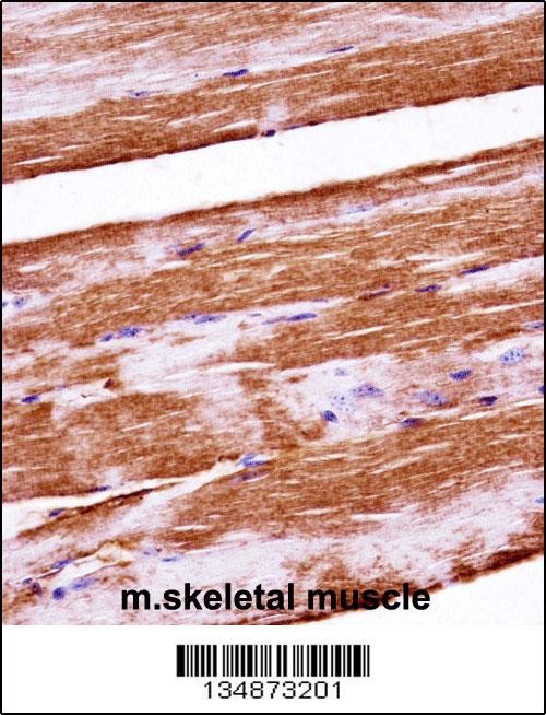 Mouse Raf1 Antibody