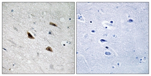 Catenin-beta (Phospho-Tyr489) antibody