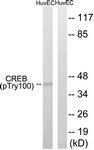 CREB (Phospho-Thr100) antibody