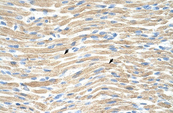 LMX1A antibody