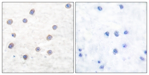 Tyrosine Hydroxylase (Phospho-Ser40) antibody