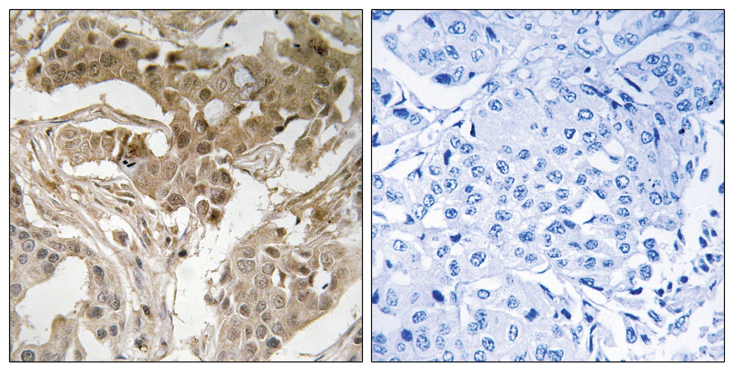FOS (phospho Thr232) Antibody