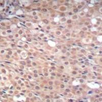 Smad3 (phospho Ser425) Antibody
