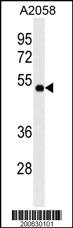 MMP14 Antibody (C-term) (Ascites)