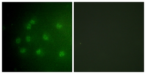 Retinoblastoma (Phospho-Thr826) antibody