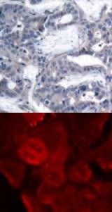 MEK 2 (phospho Thr394) Antibody