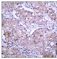 EGFR (phospho Ser1070) Antibody