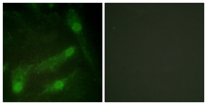 Smad2 (Phospho-Thr220) antibody