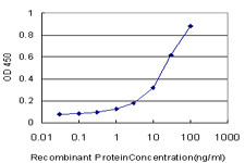 MARCH6 Antibody (monoclonal) (M02)