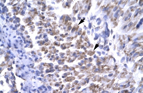ERCC8 antibody - C-terminal region