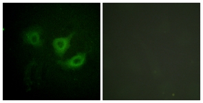 p70 S6 Kinase (Phospho-Thr389) antibody
