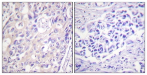 p90 RSK (Phospho-Thr359+Ser363) antibody