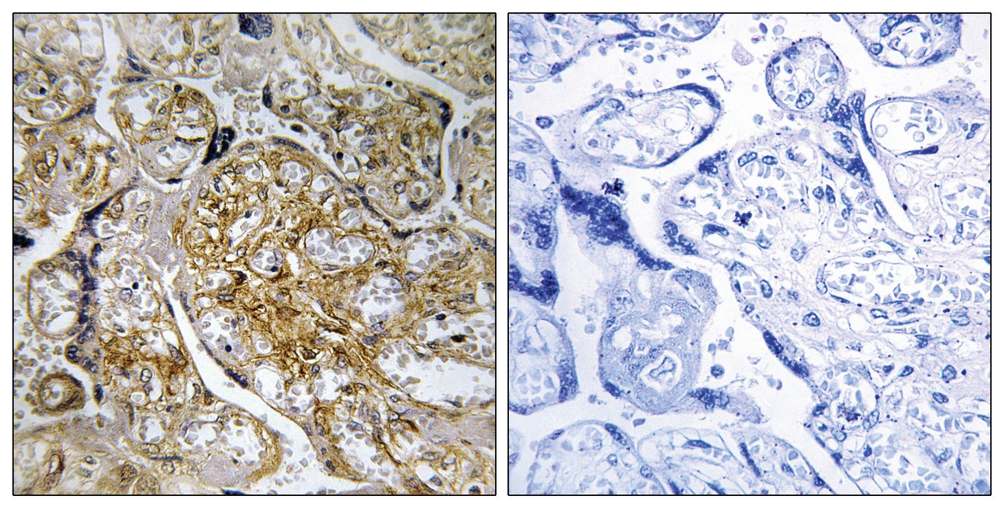 PAK1 (phospho Ser199) Antibody