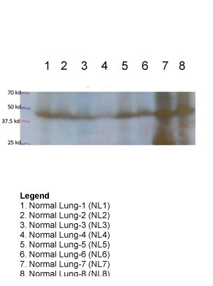 FOXA2 antibody - middle region