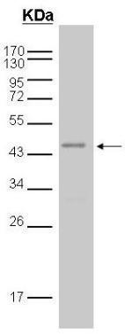 GST antibody