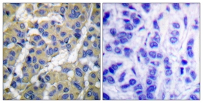 Keratin 8 (Phospho-Ser73) antibody