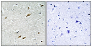 FKHR antibody