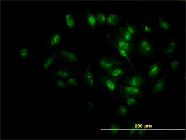 MPHOSPH10 Antibody (monoclonal) (M02)