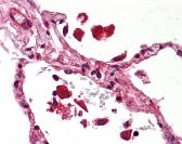 STAT1 Antibody