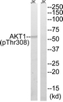 AKT1 (Phospho-Thr308) antibody