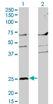 MS4A2 Antibody (monoclonal) (M02)