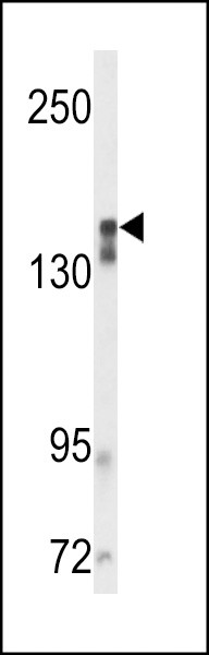 VGFR2 Antibody