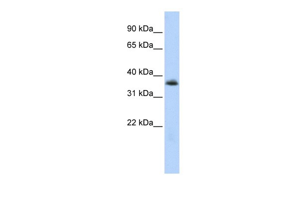 MNX1 antibody - N-terminal region