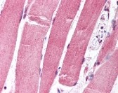 FOXO1 Antibody