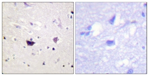 PAK1/2/3 antibody