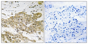 p53 (Phospho-Ser6) antibody
